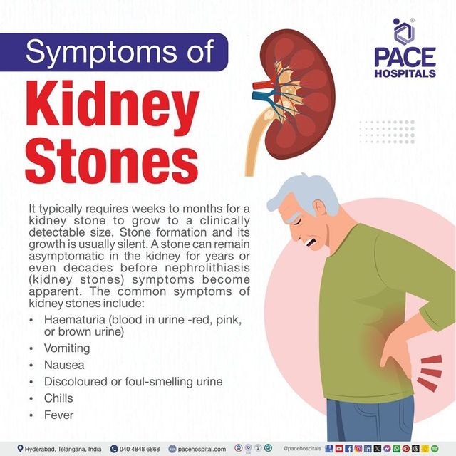 Kidney Stones Symptoms Causes Prevention and Treatment